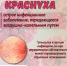 Краснуха - ГБУЗ ИКБ №2 ДЗМ