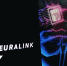 Человек с имплантом Neuralink рассказал, что пользуется им почти весь день - M24.Ru
