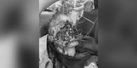 В Сочи собаки разорвали лицо 9-летнего ребенка - M24.Ru