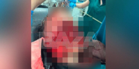 РИА Новости: покусанного двумя хаски в Сочи мальчика доставили в больницу на вертолете - M24.Ru