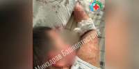 Россиянка смешала ребенку жаропонижающее с лекарствами и вызвала опасный синдром - M24.Ru
