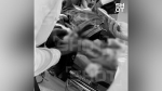 Врачи частично ампутировали пальцы ребенку, пострадавшему от взрыва в Красногорске
