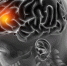 Технология реабилитационных (сенсорных/полисенсорных) перчаток - НИИ организации здравоохранения и медицинского менеджмента