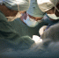 В Дербенте пациентка умерла после гистероскопии в частной клинике - ИА Общественная служба новостей